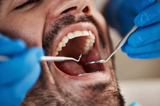 Best Emergency Gum Pain Relief  in Citronelle, AL