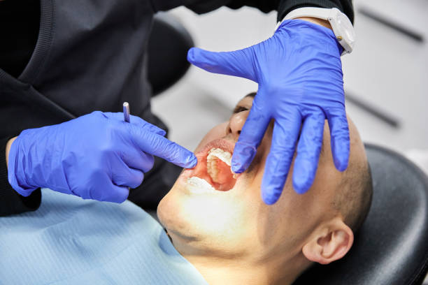 Best Knocked-Out Tooth Emergency  in Citronelle, AL
